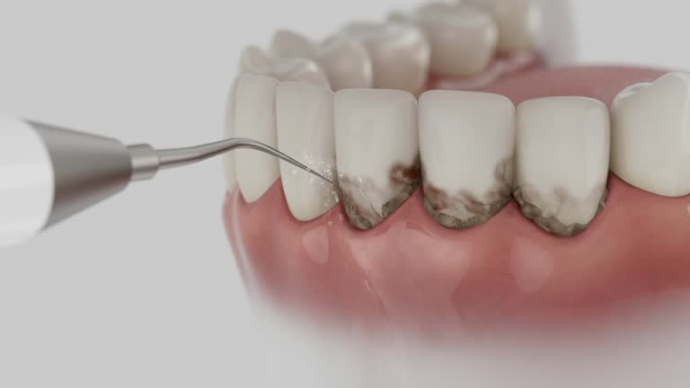 Reliable Dental contractor in Lake Linden, MI by Dentist Open Now